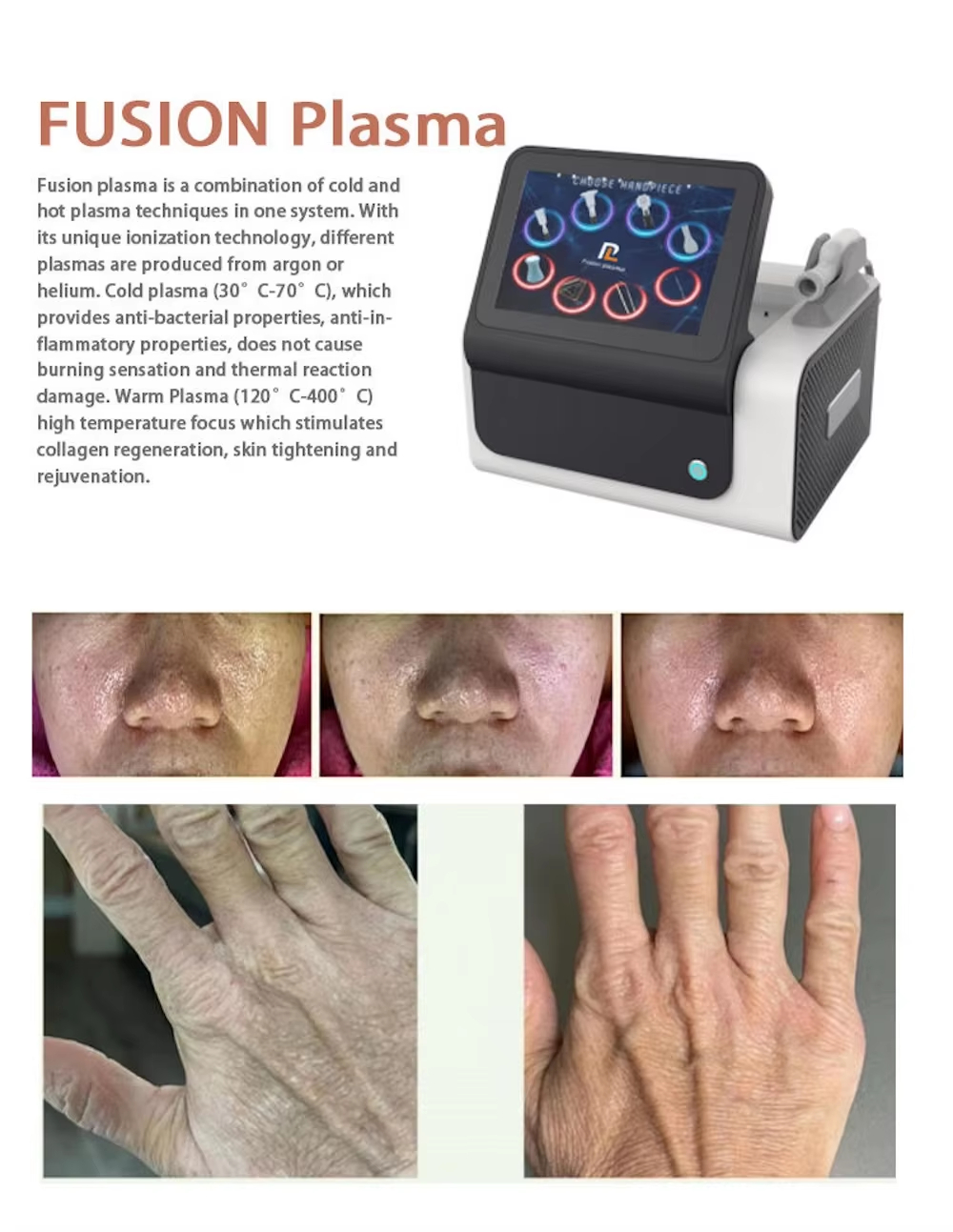 Cool Ion Beauty Device Profess - огляд і ціна Skincare Ls